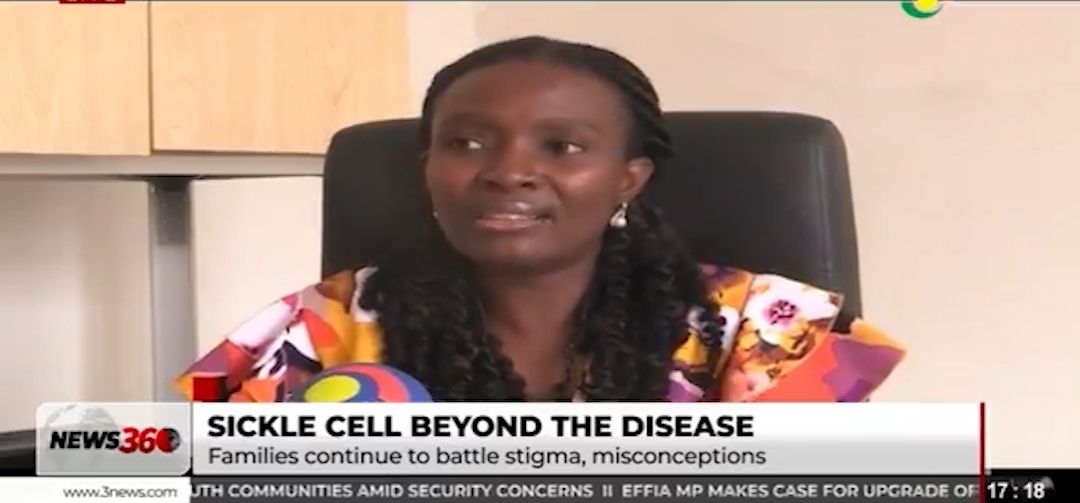 2 in every 100 babies born in Ghana have sickle cell disease - Health expert